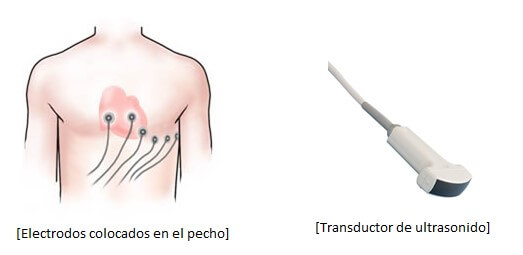 Ecocardiograma Doppler