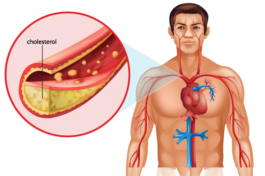 colesterol