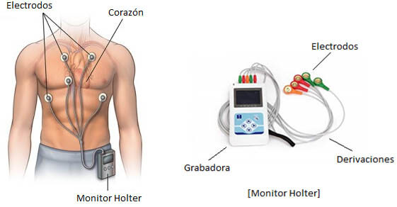 prueba holter